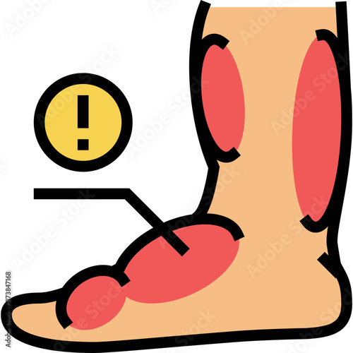 Illustration of swollen foot and ankle with an exclamation mark.