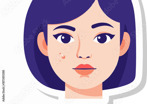 Flat illustration of a young woman's face with dark hair, showing a pimple on her cheek