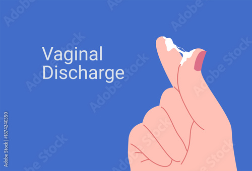 Vaginal discharge symptoms, medical concept of yeast infection, bacterial vaginosis and female reproductive health. Abnormal discharge vector illustration