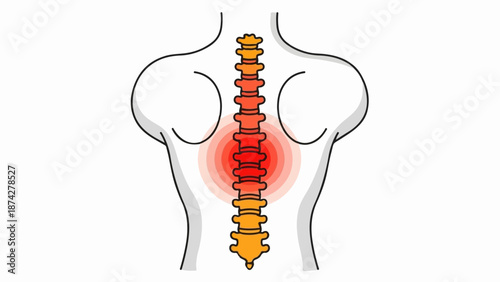 Stylized illustration of a human spine with a red, radiating heat effect indicating pain or inflammation