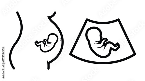 Pregnancy stages depicted with simple line drawings of a pregnant belly and ultrasound