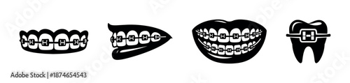 Dental braces vector icons set: orthodontic symbols, teeth alignment, smile care