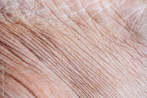 Billede på lærred A close up view shows the sry skin of a human hand with lines and wrinkles