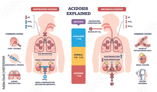 Acidosis explained contrasts respiratory and metabolic imbalance, lungs, kidneys, and pH scale highlight CO2 retention and acid buildup for quick understanding. Outline diagram