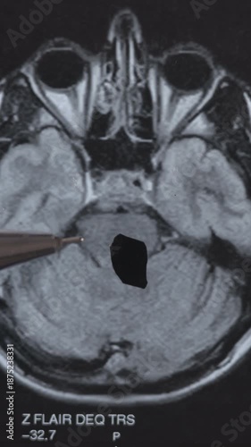 Vertical footage of CT scan of human brain. Examining disease.