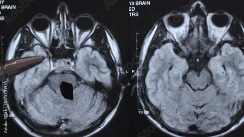 CT scan of human brain. Examining disease. Close up footage.