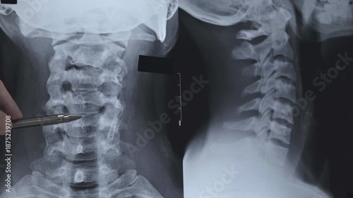 Cervical spine examination. Pain in neck after work.