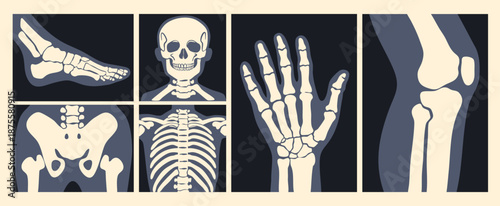 Various X Ray images. Human skeleton, foot, pelvis, arm, skull, chest, knee, ribs. Different body parts. Bone injury, medical scanning, checkup, hospital concept. Hand drawn Vector illustration 