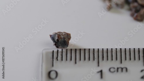 fragments of a kidney stone broken by an ultrasound wave against the background of a centimeter measuring ruler
