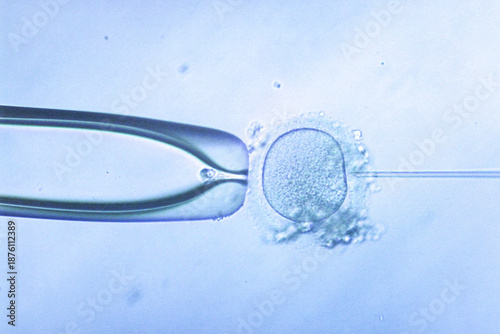 Intracytoplasmic Sperm Injection ICSI Procedure Under Microscope for IVF Infertility Treatment, Human Egg Fertilization Laboratory Technology for Assisted Reproduction and Artificial Insemination.