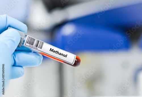 фотографія Blood sample tube for methanol test analysis.