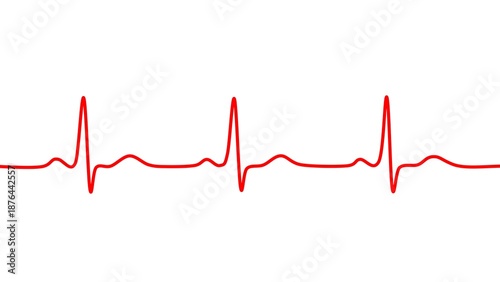 heart beat cardiogram on ecg illustration