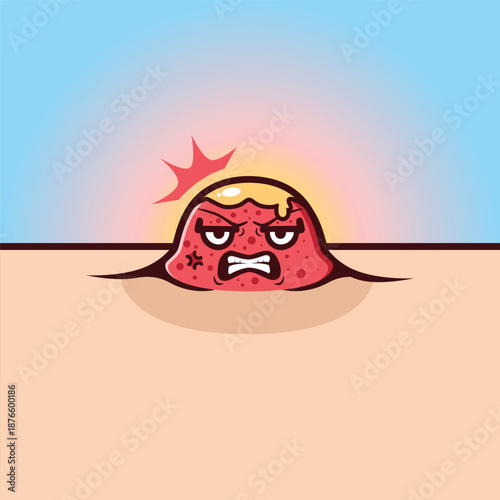 acne is about to burst cartoon