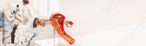 Cuadro en lienzo Gynecologist examines a patient on a bench in the background, a close-up of an anatomical model of the uterus with ovaries and appendages, symbol of female reproductive system