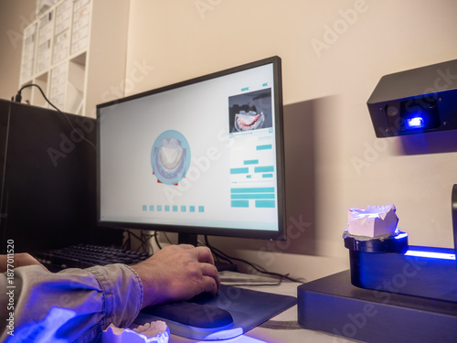 Dental 3D scanner capturing plaster model for digital impression and CAD CAM orthodontic treatment planning in modern dental technology lab.