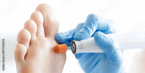 Podiatrist treating foot with precision, professional footcare in medical setting