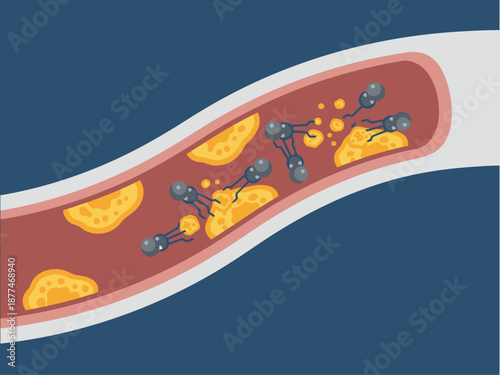 Nanobots clean cholesterol from an artery, illustrating a medical breakthrough. A vibrant, detailed illustration showcases targeted therapy for cardiovascular health.