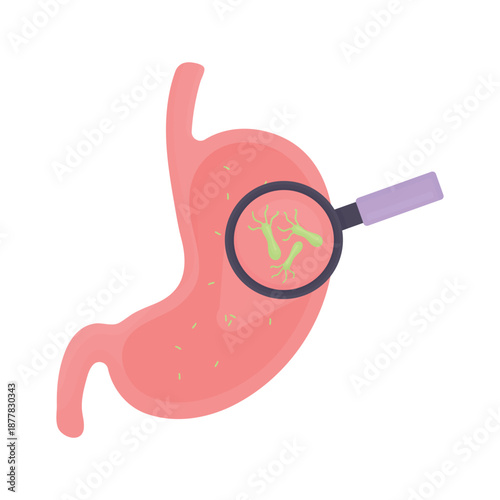 Human stomach with Helicobacter pylori bacteria. Gastric infection, gastritis and digestive system disorder concept. Medical flat vector illustration isolated on white background.