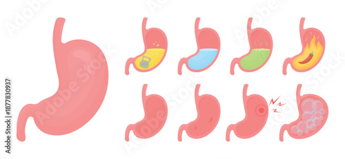 Set of human stomach with different health conditions: healthy, heaviness, bloating, ulcer, pain, high acidity, heartburn and stomach with water. Digestive system medical concept.