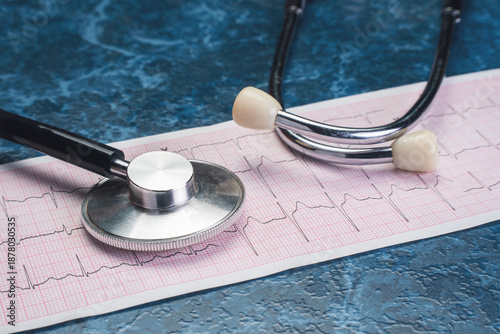 Close up of a Stethoscope on an Electrocardiogram Printout, Highlighting Heartbeat Patterns and Vital Signs in a Medical Setting