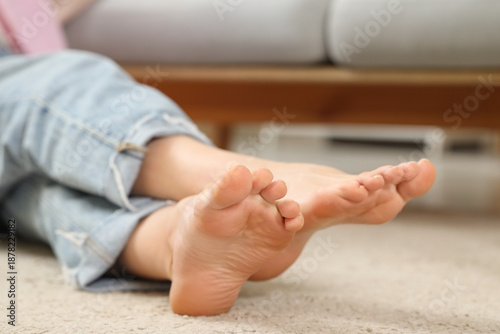 Young woman with flat feet ...