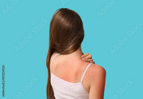 Little girl with red sunbur...