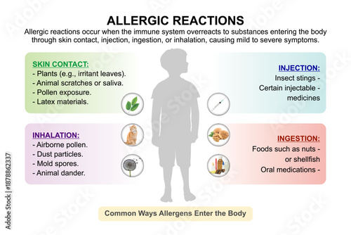Allergic reactions in kids, medical flashcard illustration