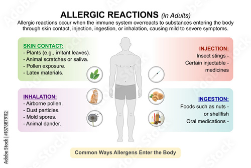 Allergic reactions in adults flashcard