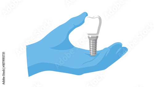 A gloved hand carefully holding a detailed dental implant, consisting of a realistic tooth crown and a screw-like fixture, symbolizing advanced dental surgery and prosthetic solutions.