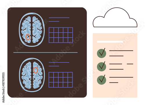 Medical diagnostics, healthcare data management, AI analysis, neurology research, cloud storage, brain imaging. Brain scans with highlighted areas and checklist. Medical diagnostics and healthcare