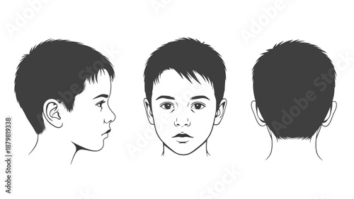Three views of a young boy's head: profile, frontal, and rear.