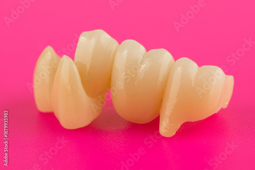ceramic dental bridge isolated on sold surface