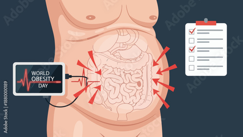 World Obesity Day Illustration Showing Abdominal Organs and Health Check List.