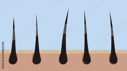 2D Hair Growth Animation on Scalp with Follicle Concept, Hair care, hair growth oil drop to root, Animation Nourish hair action of shampoo or serum