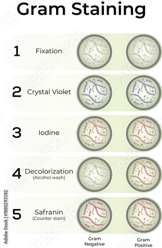 Gram Staining: A Step-by-Step Guide to Bacterial Differentiation