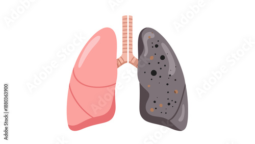 Anatomical illustration of human lungs with contrasting healthy and diseased states depicted in a side-by-side comparison view