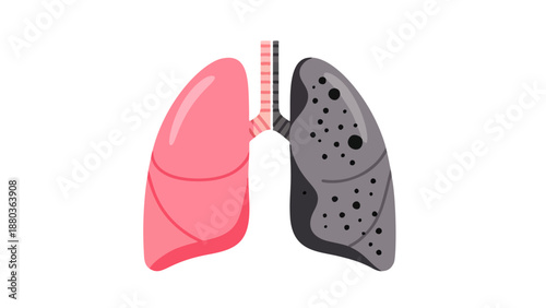 Anatomical illustration of human lungs from a front view showing contrasting healthy and diseased states