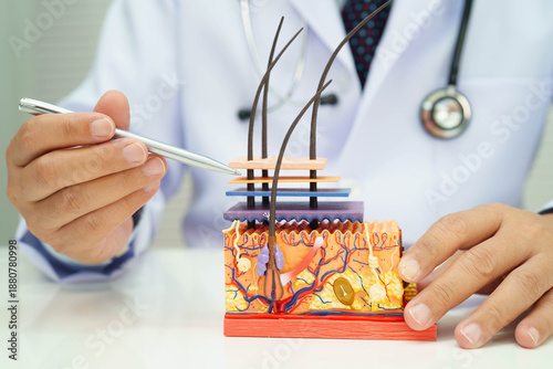 Foto Hair transplant, Asian dermatologist doctor holding skin structure anatomy model for treatment in hospital