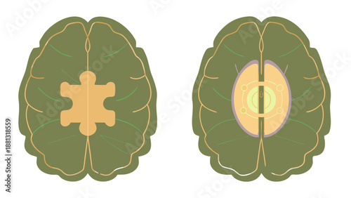Human Brain Concept with Puzzle Piece and Core for Mental Health and Logic