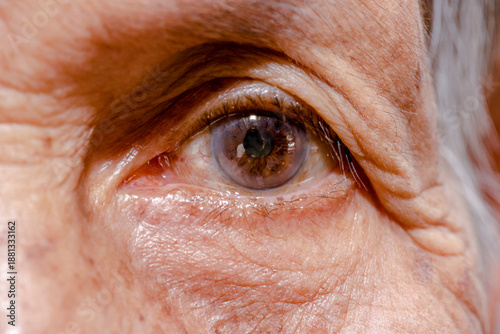 The old woman's felling lonely.(dementia and Alzheimer’s disease)