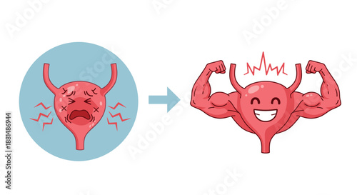 Urinary health illustration showing a painful bladder transforming into a strong and smiling organ with powerful muscular arms.
