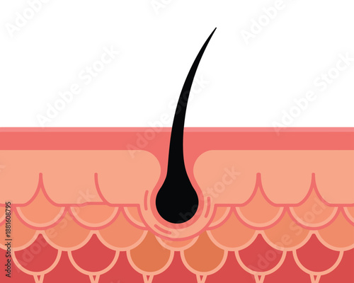 Close-up illustration of a single hair follicle growing from human skin layers