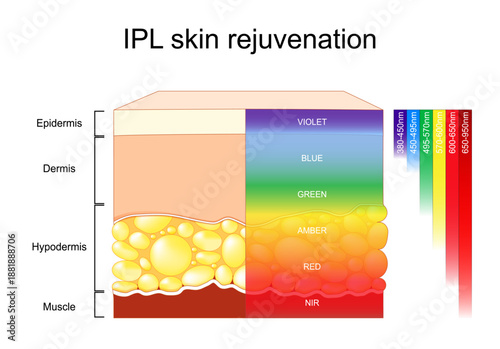 IPL skin rejuvenation. Intense Pulsed Light for skin photorejuvenation. Anti-aging therapy
