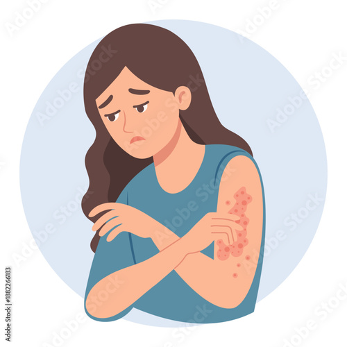 Sad woman scratches her hand. Allergic itching, skin inflammation, redness and irritation. Healthcare and medicine illustration.