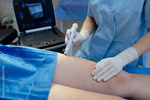 Φωτογραφία Leg ultrasound for vein check by vascular surgeon.