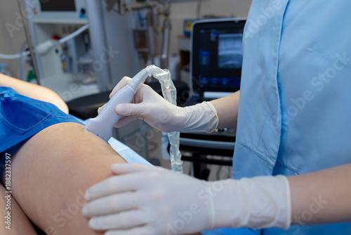 Tableau sur toile Leg ultrasound for vein check by vascular surgeon.