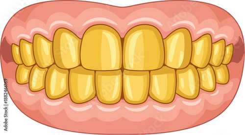 Cartoonish Full Set of Yellow Teeth with Gums Dental Illustration