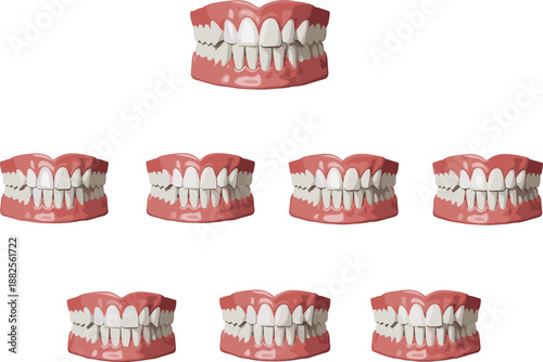 Anatomy of human teeth and jaw sets illustrating dental bite alignment for orthodontic treatment, dentistry education, prosthetic dentures, and stomatology