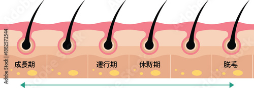 Human hair growth cycle diagram showing stages of follicle development including anagen catagen telogen and exogen phases for medical education