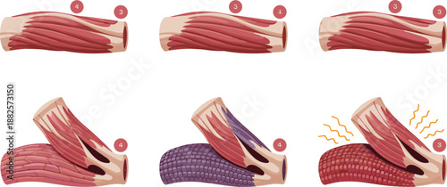 Human Muscle Tissue Cross Section Diagram showing Fiber Bundles and Cellular Structure with Six Numbered Steps for Medical Education Illustration